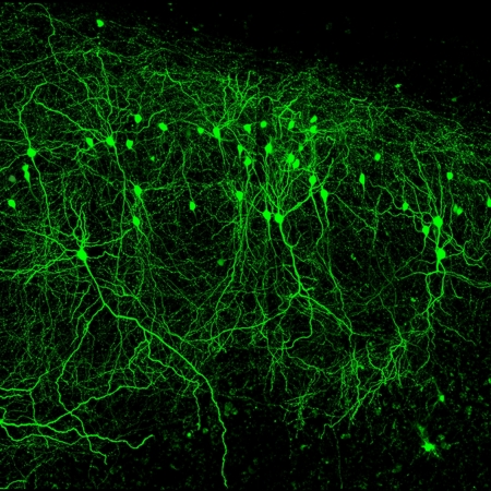 Microscope image showing fluorescent green brain cells